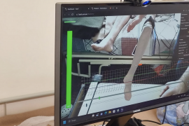 У Вінниці військовим, які втратили кінцівки, допомагають зменшити біль за допомогою IT-технологій